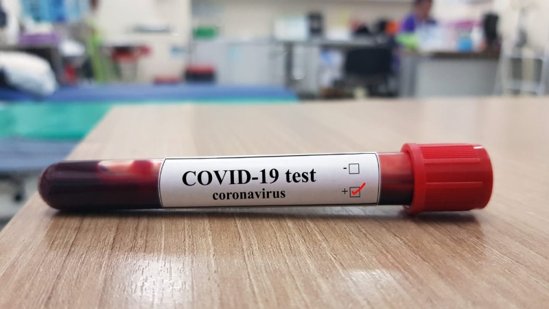 Corrientes suma siete muertos por coronavirus y la cifra llega a 951