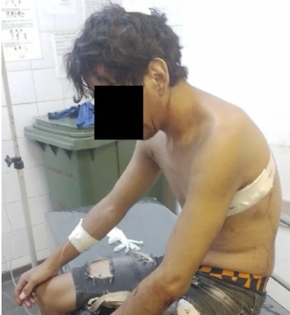 Dos hermanos resultaron acuchillados en una pelea entre familias en Corrientes