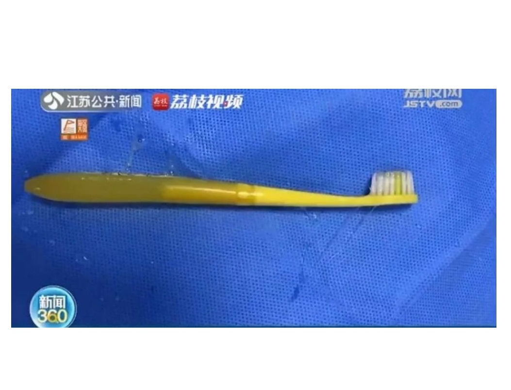 Se levantó medio dormido y casi muere al tragarse su cepillo de dientes
