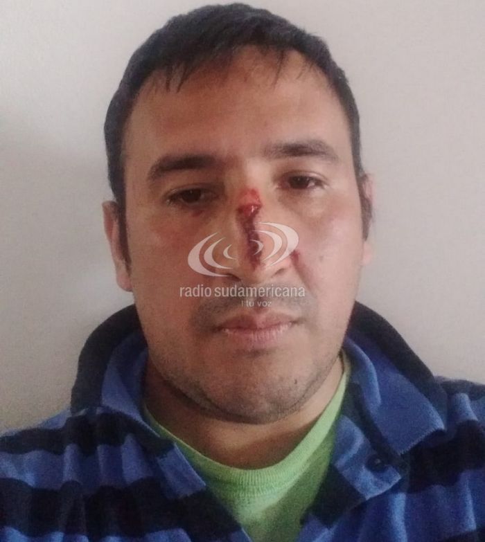 Esquina: un hombre denunció que fue agredido por su hermana