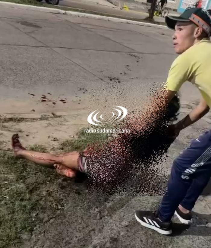 Terrible accidente entre dos motos provocó que una joven pierda el brazo