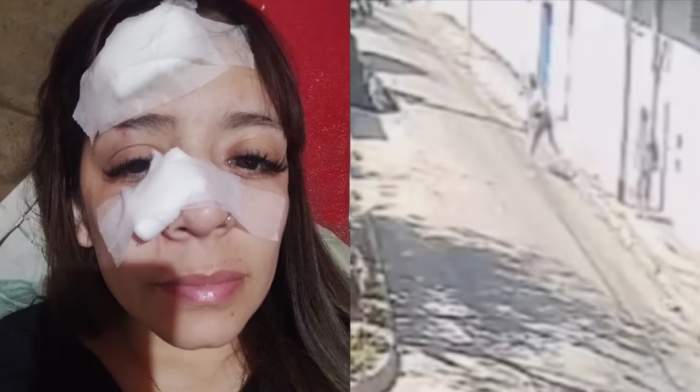 Una mujer se negó a darles comida a dos personas y le fracturaron la nariz con una piedra