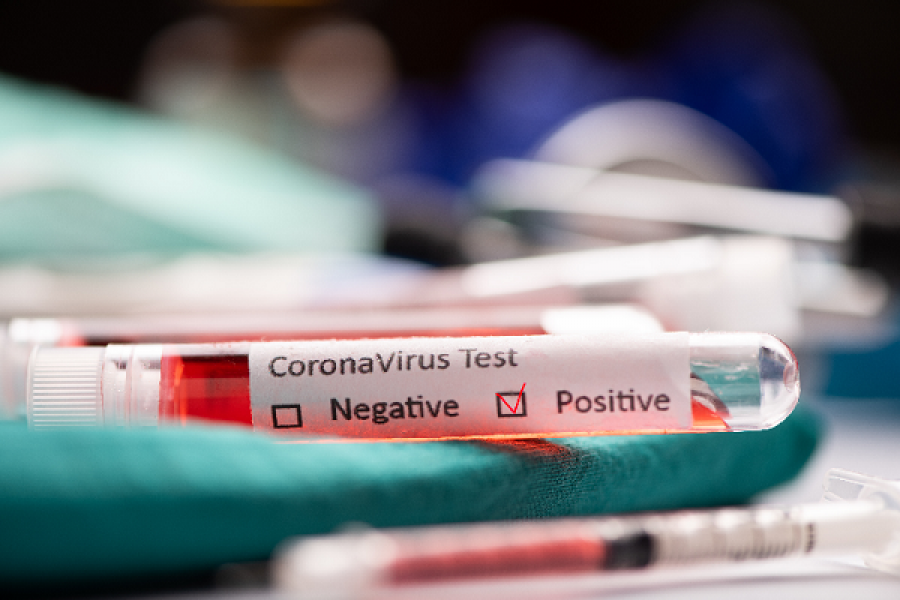 Coronavirus en Esquina: hay dos casos nuevos