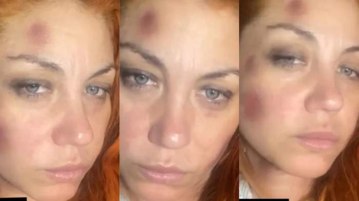 Golpes y moretones: la acusación de violencia de género de una ex Bandana