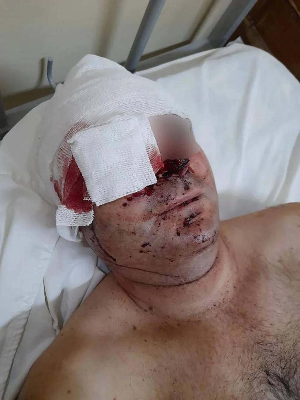 Uno de los prefectos baleados cerca de Monte Caseros recibió 50 perdigones en el rostro y perdió la visión