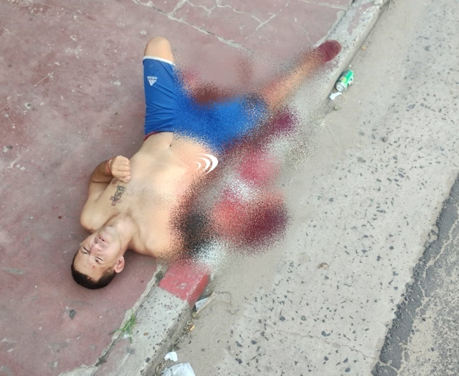 Goya: un carpincho le mordió el brazo y casi muere desangrado
