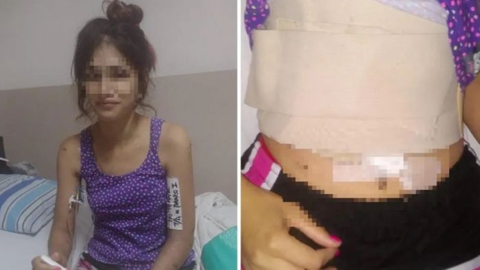 "Es una basura", dijo la correntina que recibió 15 puñaladas de su ex pareja
